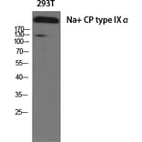 Western Blot - Anti-SCN9A Antibody (C18819) - Antibodies.com