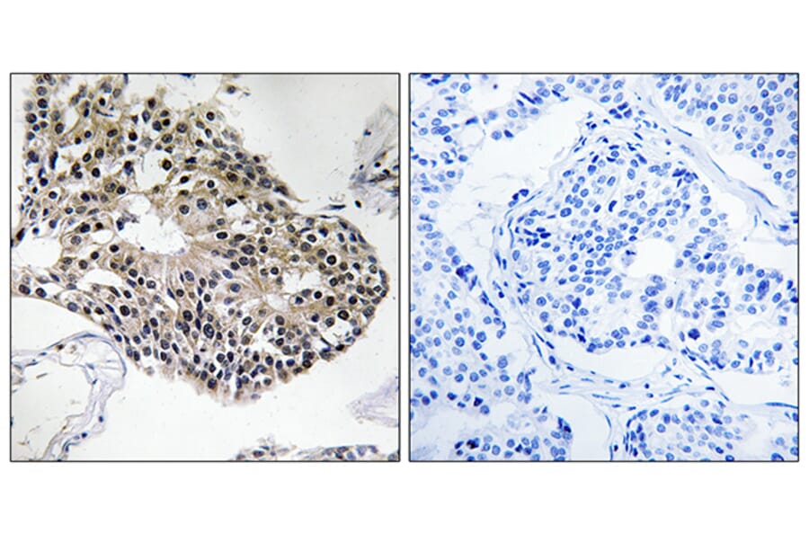 Immunohistochemistry - Anti-RPS25 Antibody (C14110) - Antibodies.com