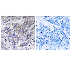 Immunohistochemistry - Anti-RPS21 Antibody (C14107) - Antibodies.com