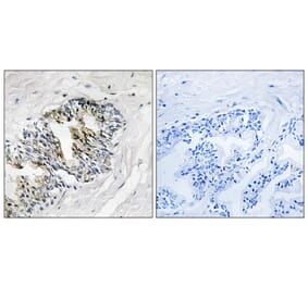 Immunohistochemistry - Anti-RPLP2 Antibody (C14143) - Antibodies.com