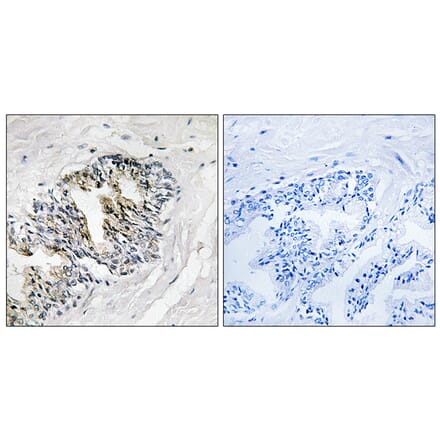 Immunohistochemistry - Anti-RPLP2 Antibody (C14143) - Antibodies.com