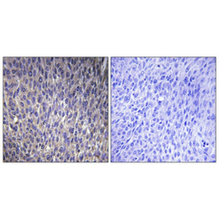 Immunohistochemistry - Anti-RPL40 Antibody (C14185) - Antibodies.com