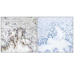 Immunohistochemistry - Anti-RPL31 Antibody (C14170) - Antibodies.com