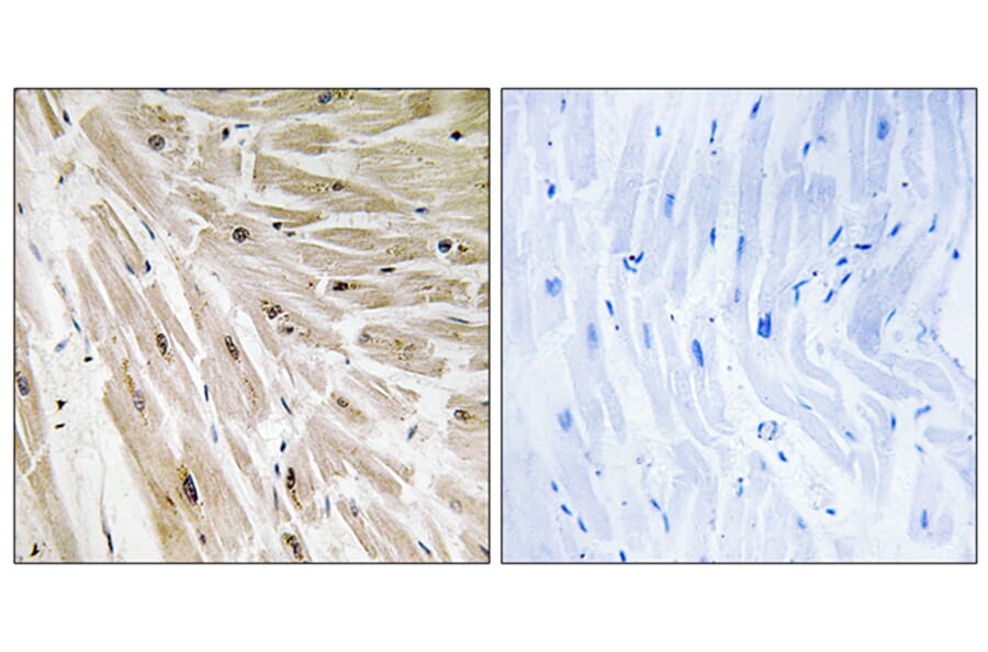 Immunohistochemistry - Anti-RPL22 Antibody (C14158) - Antibodies.com