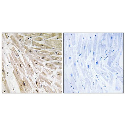 Immunohistochemistry - Anti-RPL22 Antibody (C14158) - Antibodies.com