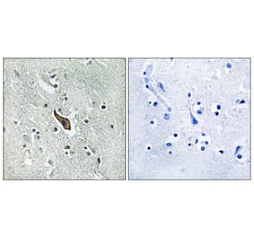 Immunohistochemistry - Anti-ROBO2 Antibody (C18467) - Antibodies.com