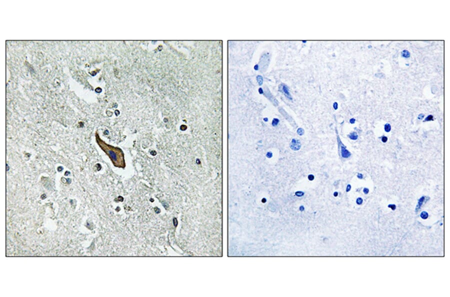 Immunohistochemistry - Anti-ROBO2 Antibody (C18467) - Antibodies.com