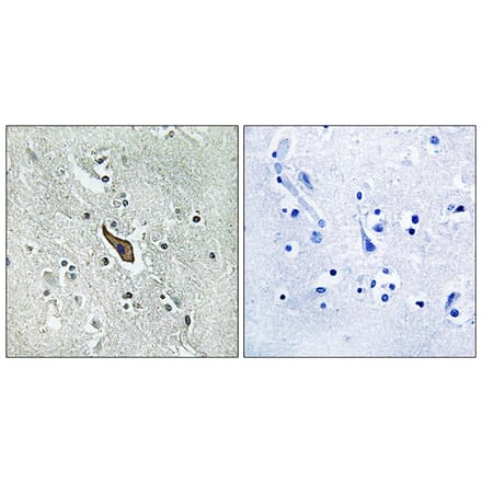 Immunohistochemistry - Anti-ROBO2 Antibody (C18467) - Antibodies.com