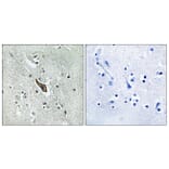Immunohistochemistry - Anti-ROBO2 Antibody (C18467) - Antibodies.com