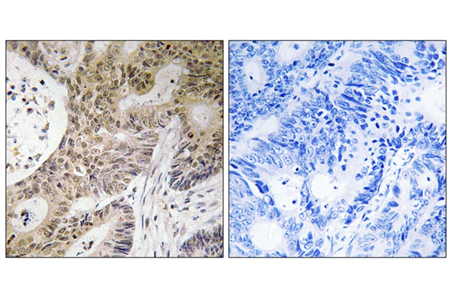 Immunohistochemistry - Anti-PRPF6 Antibody (C17850) - Antibodies.com