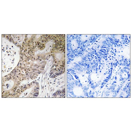 Immunohistochemistry - Anti-PRPF6 Antibody (C17850) - Antibodies.com