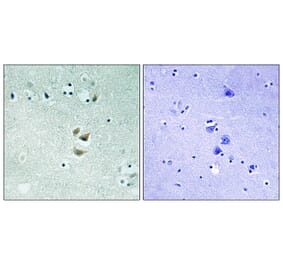 Immunohistochemistry - Anti-PRKCA Antibody (B8533) - Antibodies.com