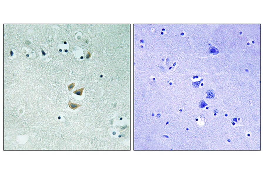 Immunohistochemistry - Anti-PRKCA Antibody (B8533) - Antibodies.com