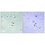 Immunohistochemistry - Anti-PRKCA Antibody (B8533) - Antibodies.com