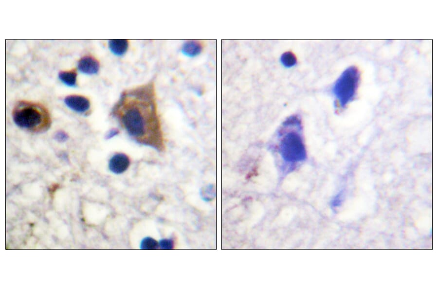 Immunohistochemistry - Anti-PIP5K Antibody (B1176) - Antibodies.com