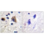 Immunohistochemistry - Anti-PIP5K Antibody (B1176) - Antibodies.com