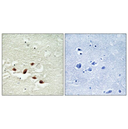 Immunohistochemistry - Anti-PDCD4 Antibody (B1174) - Antibodies.com