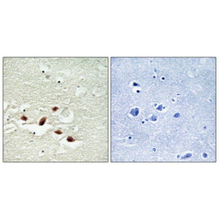 Immunohistochemistry - Anti-PDCD4 Antibody (B1174) - Antibodies.com