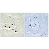 Immunohistochemistry - Anti-PDCD4 Antibody (B1174) - Antibodies.com