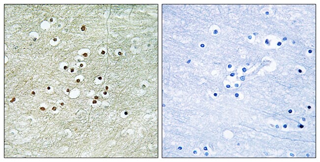 Immunohistochemical analysis of paraffin-embedded human brain tissue using Anti-NPAS4 Antibody. The right hand panel represents a negative control, where the antibody was pre-incubated with the immunising peptide.