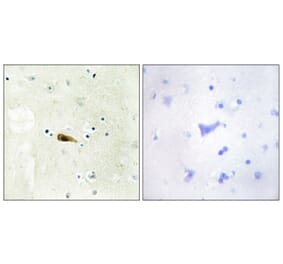 Immunohistochemistry - Anti-MYST1 Antibody (C11704) - Antibodies.com