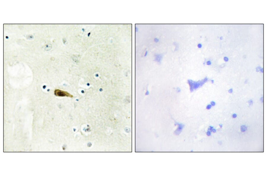 Immunohistochemistry - Anti-MYST1 Antibody (C11704) - Antibodies.com