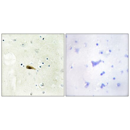 Immunohistochemistry - Anti-MYST1 Antibody (C11704) - Antibodies.com