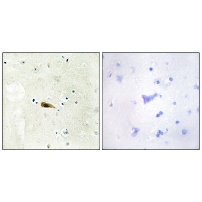 Immunohistochemistry - Anti-MYST1 Antibody (C11704) - Antibodies.com
