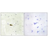 Immunohistochemistry - Anti-MYST1 Antibody (C11704) - Antibodies.com