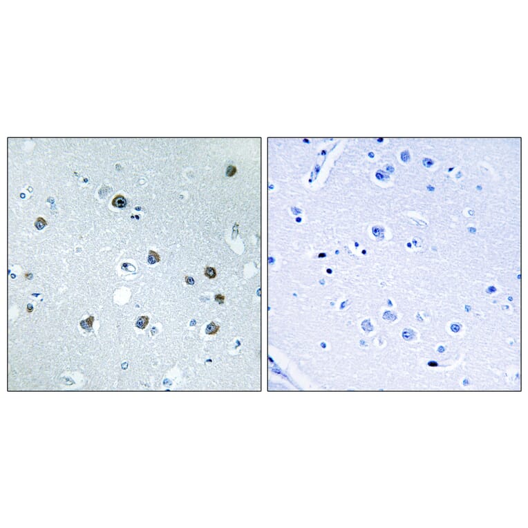 Immunohistochemistry - Anti-MYO1D Antibody (C16783) - Antibodies.com