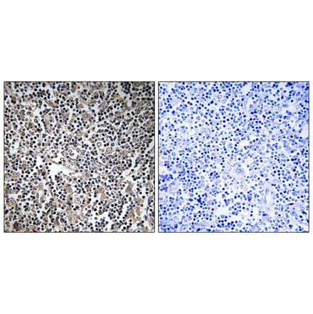 Immunohistochemistry - Anti-MPRIP Antibody (C16762) - Antibodies.com