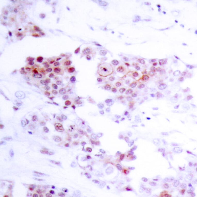 Immunohistochemistry - Anti-MEF2A Antibody (B7145) - Antibodies.com
