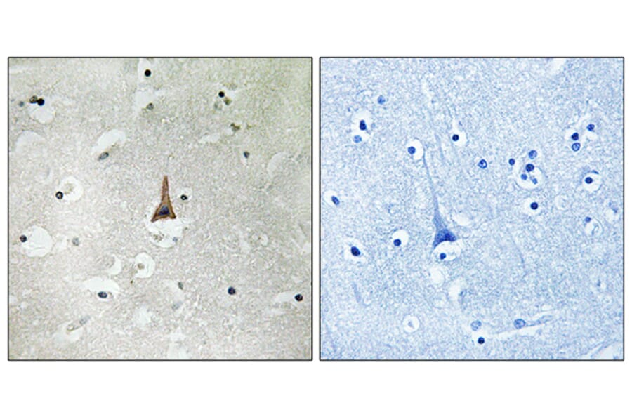 Immunohistochemistry - Anti-LRP10 Antibody (C16507) - Antibodies.com