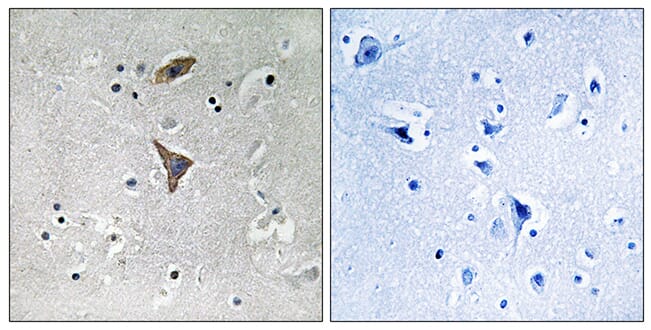 Immunohistochemical analysis of paraffin-embedded human brain tissue using Anti-KCNT1 Antibody. The right hand panel represents a negative control, where the antibody was pre-incubated with the immunising peptide.