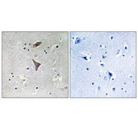 Immunohistochemistry - Anti-KCNT1 Antibody (C17788) - Antibodies.com