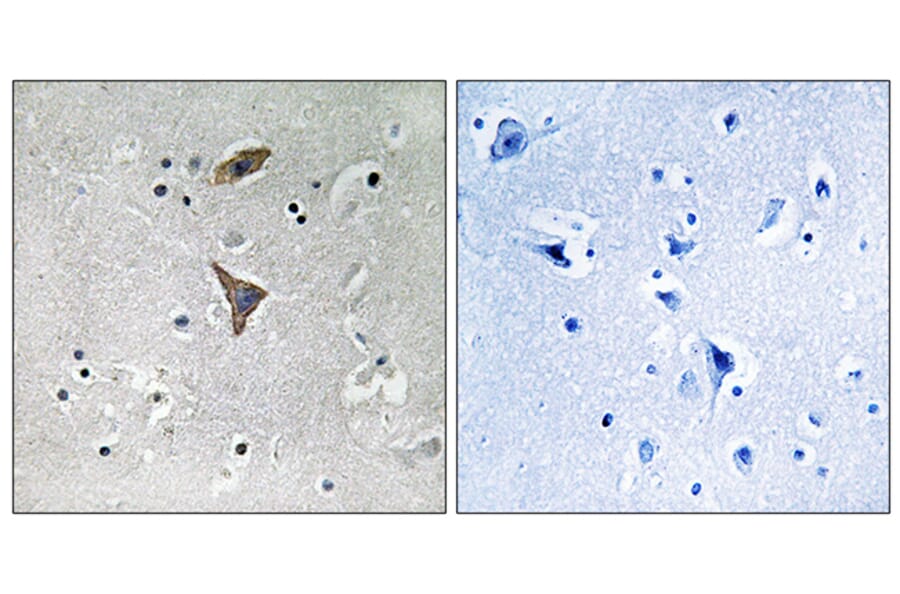 Immunohistochemistry - Anti-KCNT1 Antibody (C17788) - Antibodies.com