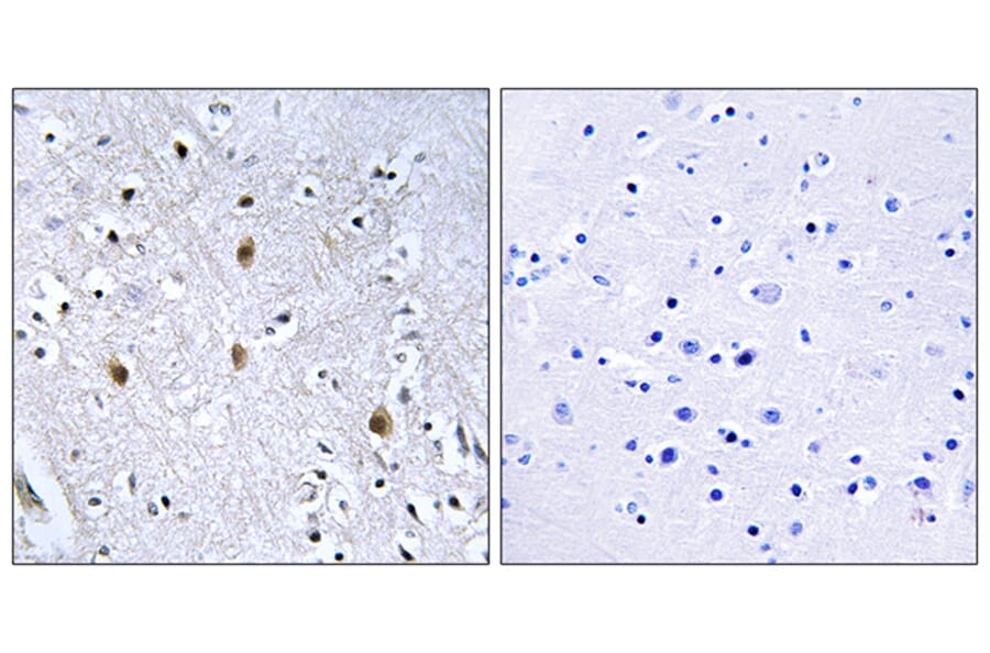 Immunohistochemistry - Anti-IRS-1 Antibody (B7123) - Antibodies.com
