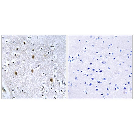 Immunohistochemistry - Anti-IRS-1 Antibody (B7123) - Antibodies.com