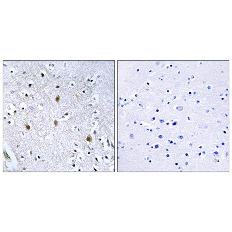 Immunohistochemistry - Anti-IRS-1 Antibody (B7123) - Antibodies.com
