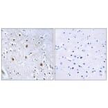 Immunohistochemistry - Anti-IRS-1 Antibody (B7123) - Antibodies.com