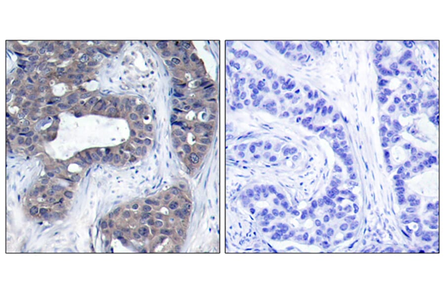 Immunohistochemistry - Anti-IRS-1 Antibody (B7120) - Antibodies.com