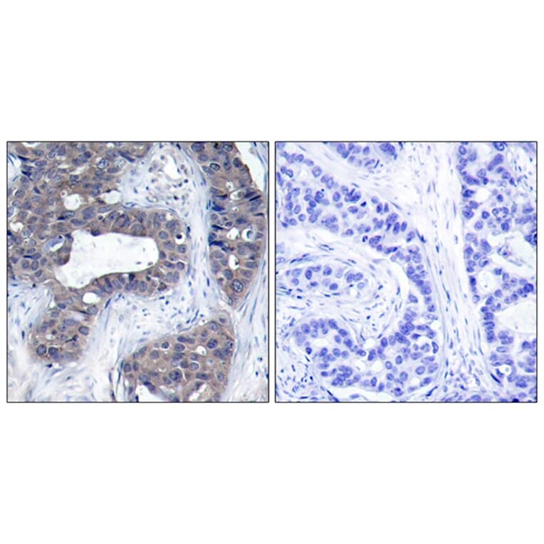 Immunohistochemistry - Anti-IRS-1 Antibody (B7120) - Antibodies.com