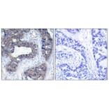 Immunohistochemistry - Anti-IRS-1 Antibody (B7120) - Antibodies.com