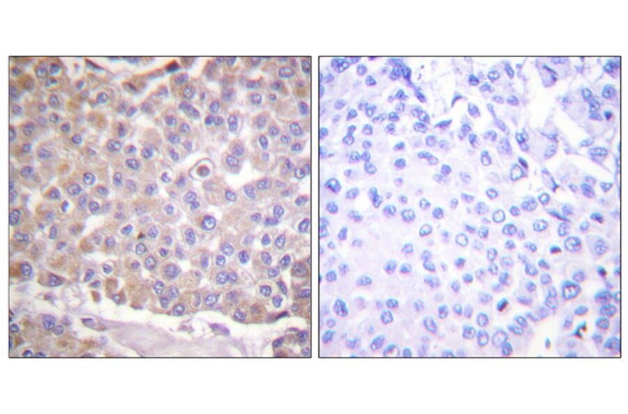 Immunohistochemistry - Anti-IRS-1 Antibody (B0446) - Antibodies.com