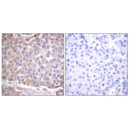 Immunohistochemistry - Anti-IRS-1 Antibody (B0446) - Antibodies.com