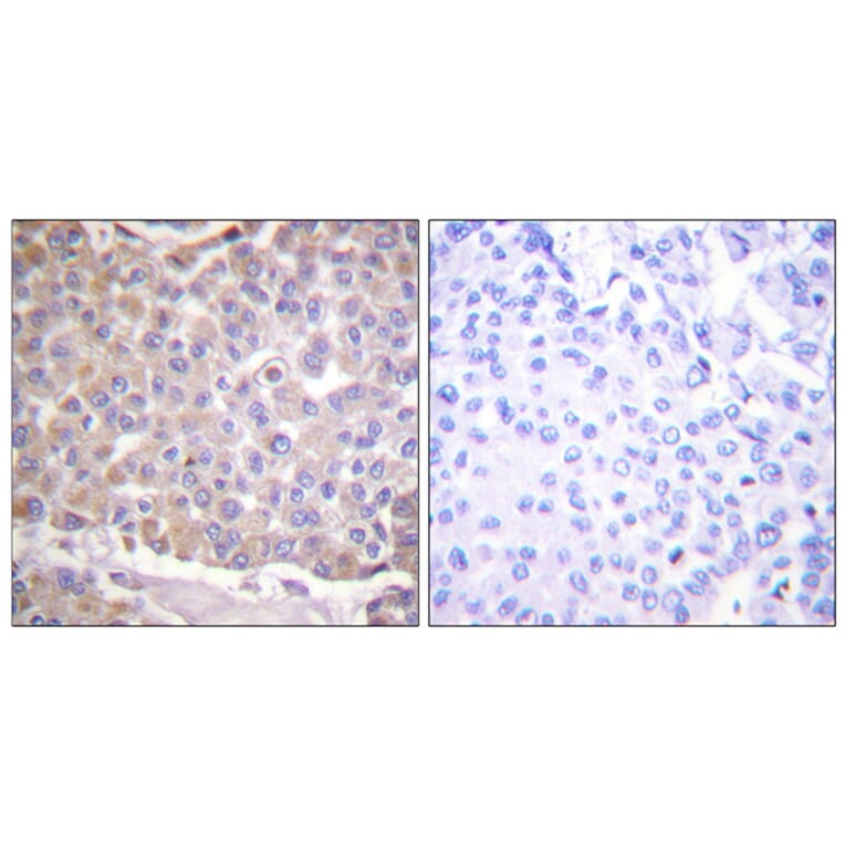 Immunohistochemistry - Anti-IRS-1 Antibody (B0446) - Antibodies.com