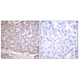 Immunohistochemistry - Anti-IRS-1 Antibody (B0446) - Antibodies.com