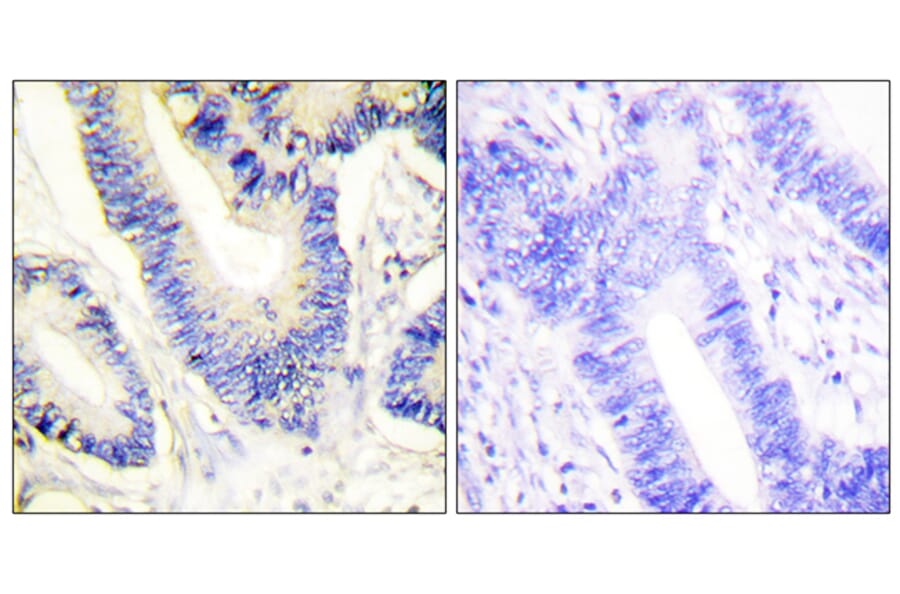 Immunohistochemistry - Anti-IRS-1 Antibody (B0447) - Antibodies.com