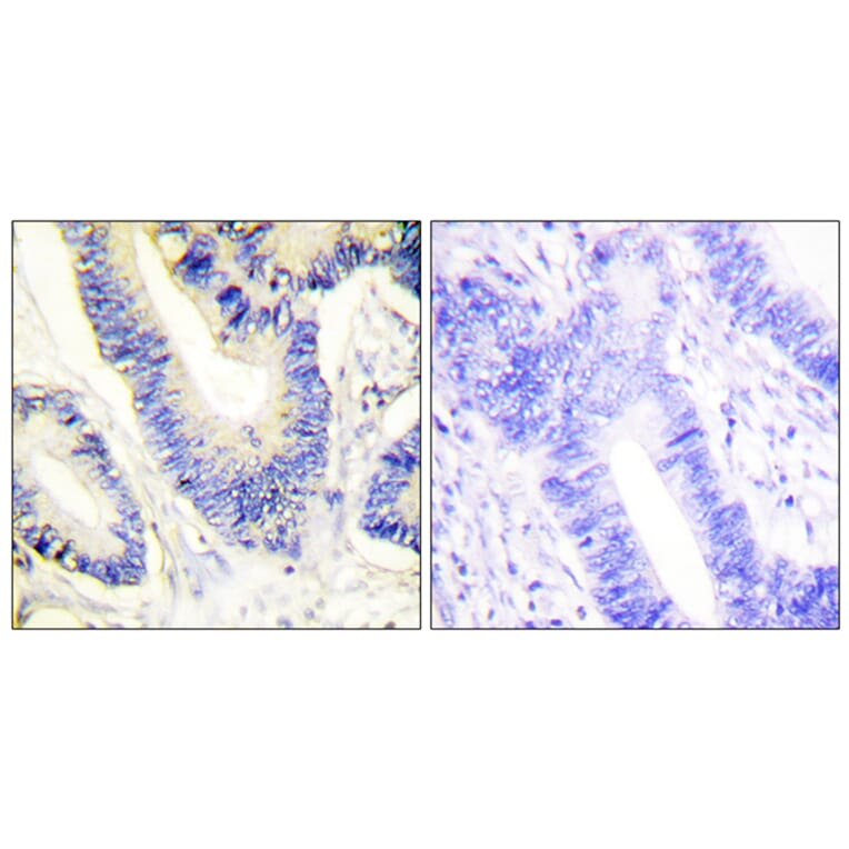 Immunohistochemistry - Anti-IRS-1 Antibody (B0447) - Antibodies.com