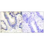 Immunohistochemistry - Anti-IRS-1 Antibody (B0447) - Antibodies.com